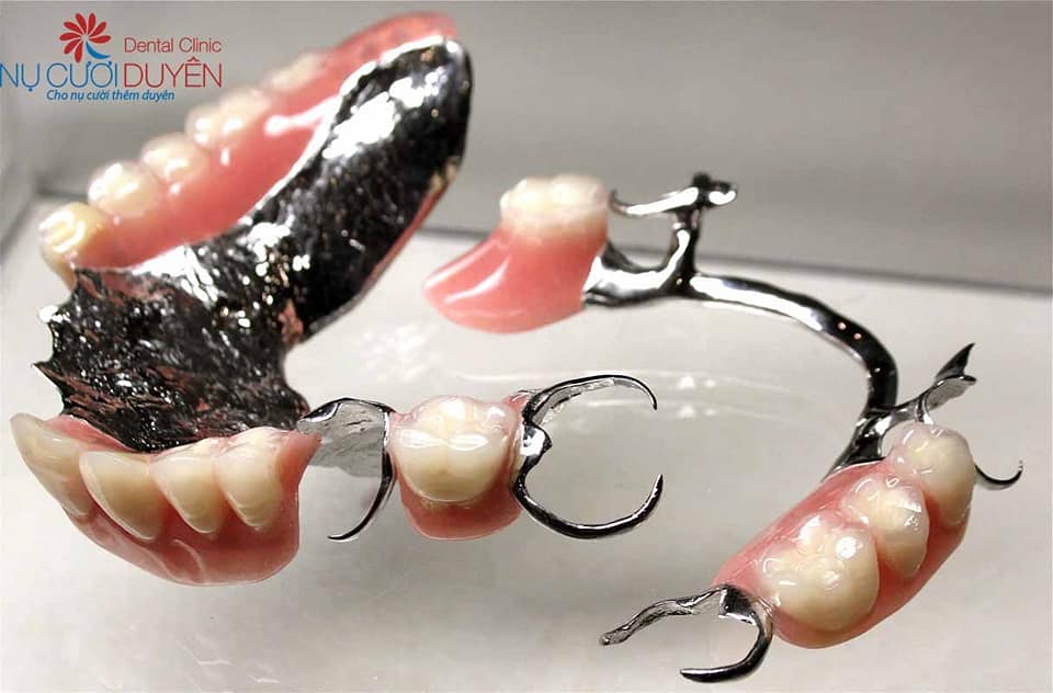 HÀM KHUNG KIM LOẠI THƯỜNG