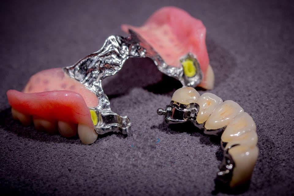 HÀM KHUNG LIÊN KẾT